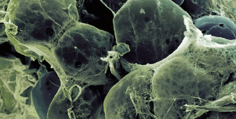 Новий погляд на смерть клітин, як некроз впливає на старіння і здоров’я